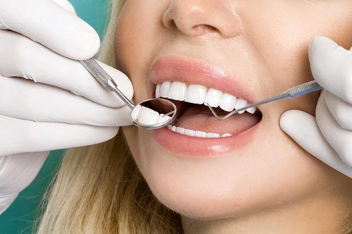  A Unique Solution of Treatment to Straighten Teeth